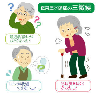 こんな症状ありませんか？　正常圧水頭症外来